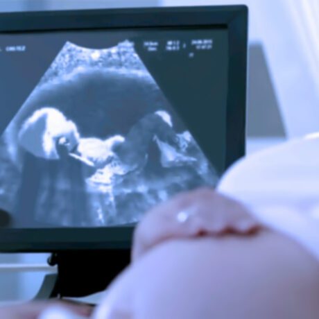 O femeie însărcinată care face o ecografie cu ultrasunete