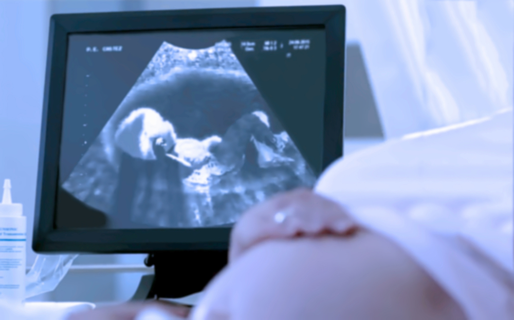 O femeie însărcinată care face o ecografie cu ultrasunete