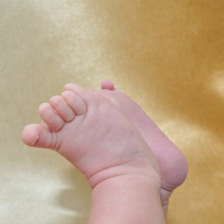 Picioare de bebeluș cu degete care au sindromul turnichetului, pe un fundal auriu