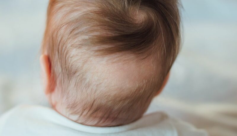 De ce cade părul bebelușului