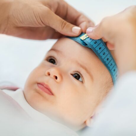 Capul unui bebeluș care este măsurat cu un centimetru albastru pentru a vedea dacă se confruntă cu hidrocefalia