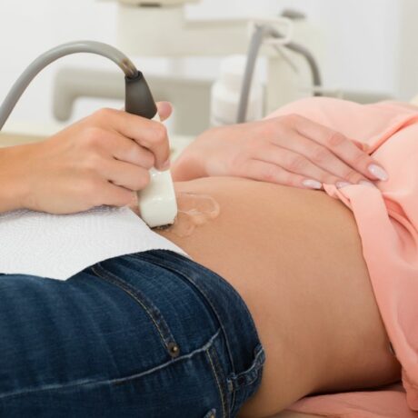 Femeie îmbrăcată cu o bluză în nuanța piersicii, pe care o ține ridicată cu mână, stă întinsă pe pat, în cabinetul de ginecologie, iar medicul îi face o ecografie abdominală pentru a verifica sarcina fără embrion, acoperind partea de sus a pantalonilor din jeans bleumarin cu un servețel alb,din hârtie