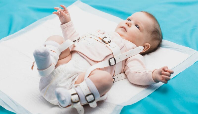 Displazia de șold la bebeluși. Care sunt cauzele și cum se poate trata