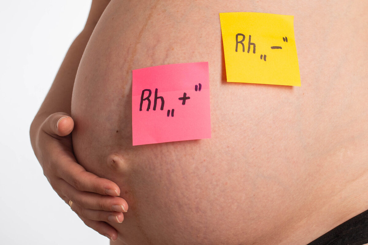 O burtică de gravidă pe care sunt lipite două sticky notes, de culoare roz și galben, pe care sunt scrise factorul Rh negativ și pozitiv