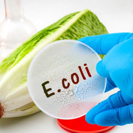 Ce trebuie să știi despre infecția cu E.coli: cauze, simptome și tratament