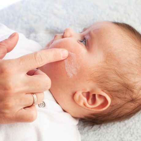 Mama îl dă pe bebeluș cu cremă pe față pentru dermatită atopică