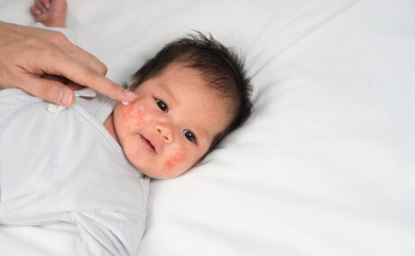 Bebeluș care stă întins pe pat și mama îl dă cu cremă pe față