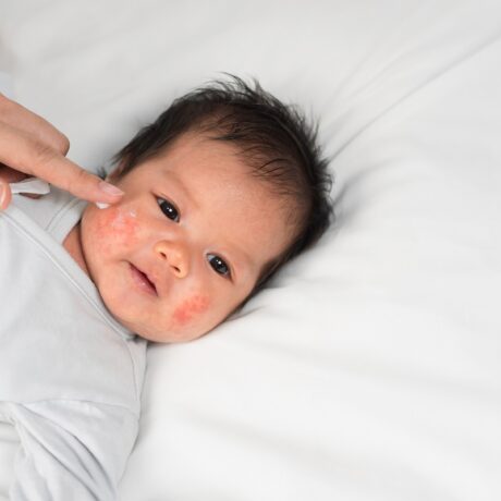 Bebeluș care stă întins pe pat și mama îl dă cu cremă pe față