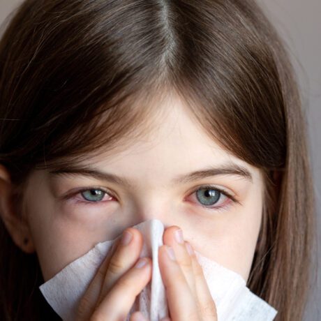 O fetiță cu ochii inflamați, care își suflă nasul