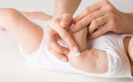 Mama dă copilul cu cremă peste eczemele de pe piele