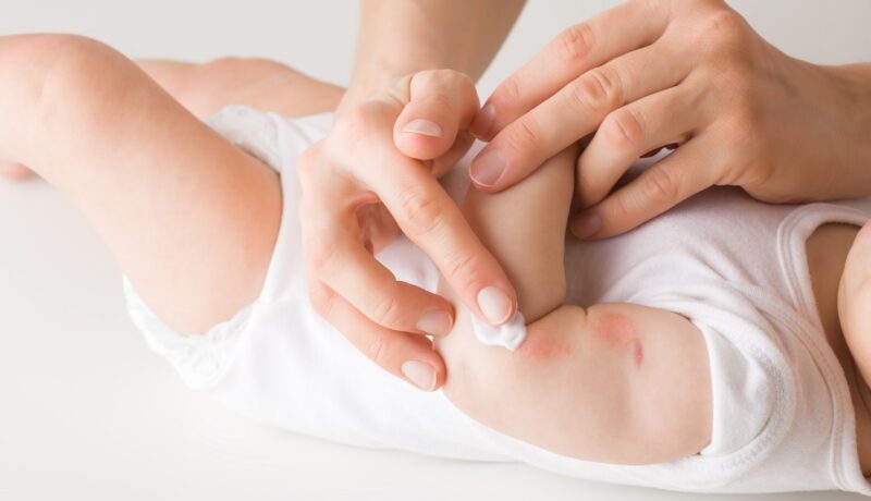 Mama dă copilul cu cremă peste eczemele de pe piele