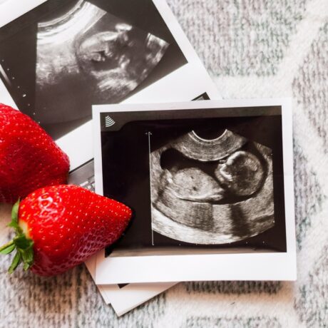 Poze cu ecografii de sarcină și căpșuni