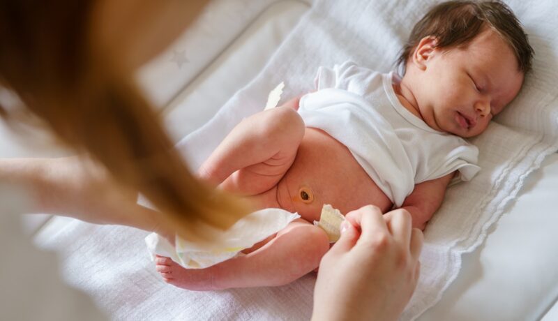 Cum se tratează omfalita la nou-născuți
